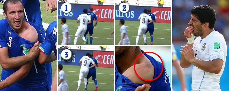 Suarez Main Gigit Lagi sedang Diselidiki FIFA 